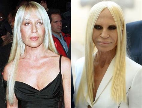 donatella versace documentary netflix cast and crew|donatella versace before plastic surgery.